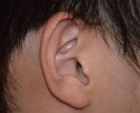 耳掃除注意報発令 耳かきで鼓膜をこすってしまっている人が意外と多い事実 マイナビウーマン