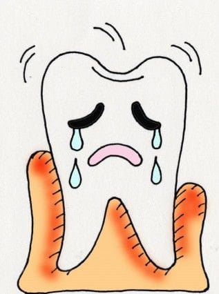 歯科医に聞く インフルエンザで歯が 歯ぐきが痛い 口も臭い これって何で マイナビウーマン