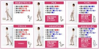 歩行姿勢のタイプ分類