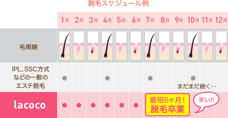 脱毛スケジュール