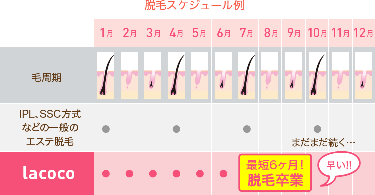 Vio脱毛のリアル やるorやらない どっちが多数派 痛くない デザインは マイナビウーマン