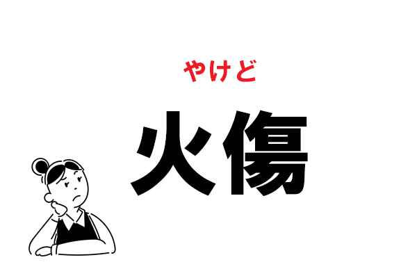 難読 かしょう じゃない 火傷 の正しい読み方 マイナビウーマン