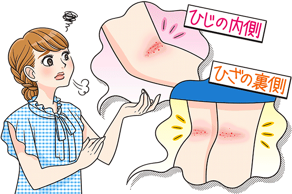 ついかきすぎちゃう皮膚トラブル 早く治すための対処法とは マイナビウーマン