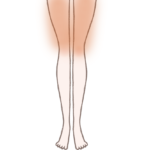 太もものニキビ占いのイラスト