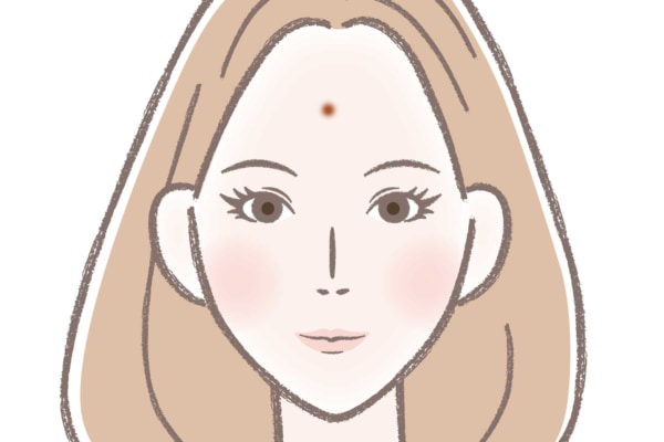 ニキビ占い　女性の額にニキビがあるイラスト