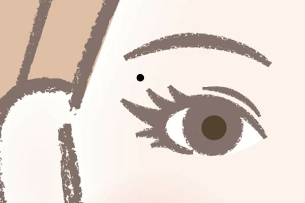 左目のほくろページ 目の周りのほくろ除去(目の上・目の下)｜大山皮膚科｜足立区 五