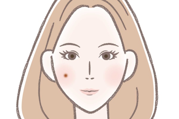 ニキビ占い　女性の右頬にニキビがあるイラスト