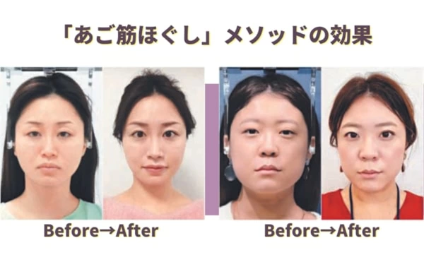 小顔＆リフトアップメソッド、書籍『90秒 あご筋ほぐし』が発売