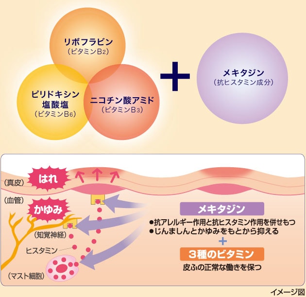 仕事で疲れた身体に突然かゆみが……！　じんましんに悩む私を救ってくれたケアアイテムとは？