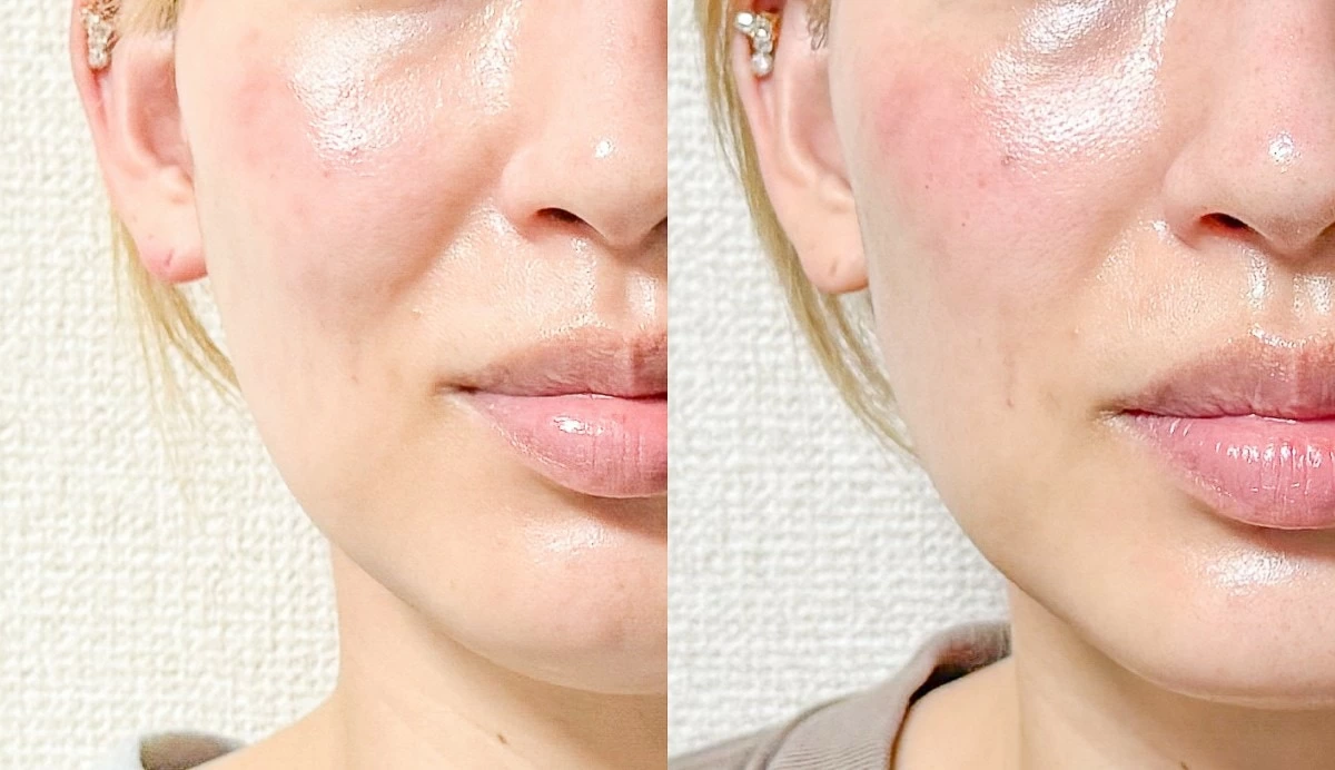 1週間続けたらどう変わる？ 2つの球体で表情筋をダイレクトに刺激する